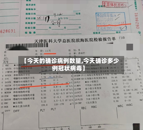 【今天的确诊病例数量,今天确诊多少例冠状病毒】-第2张图片