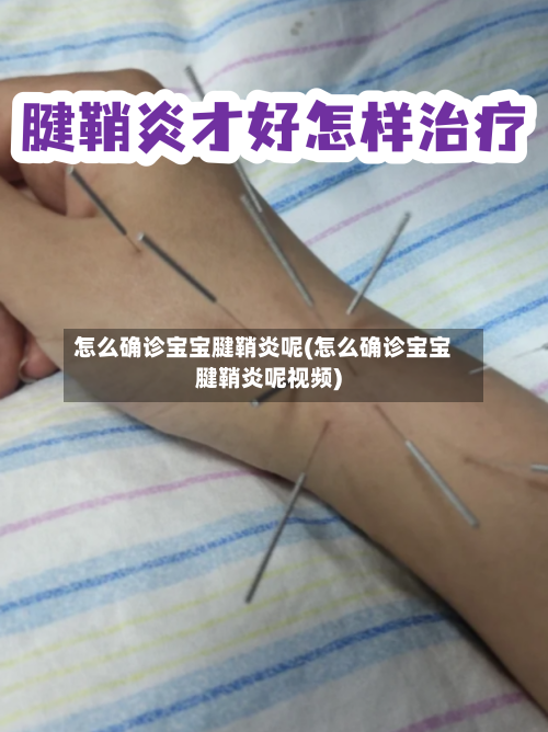 怎么确诊宝宝腱鞘炎呢(怎么确诊宝宝腱鞘炎呢视频)-第2张图片