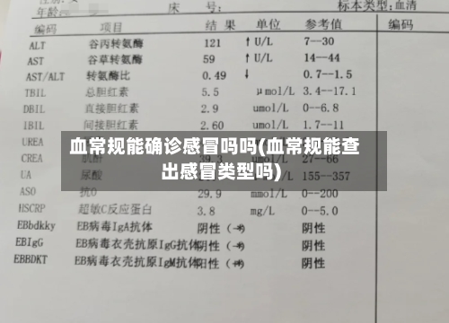 血常规能确诊感冒吗吗(血常规能查出感冒类型吗)