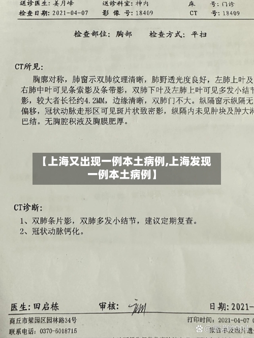 【上海又出现一例本土病例,上海发现一例本土病例】