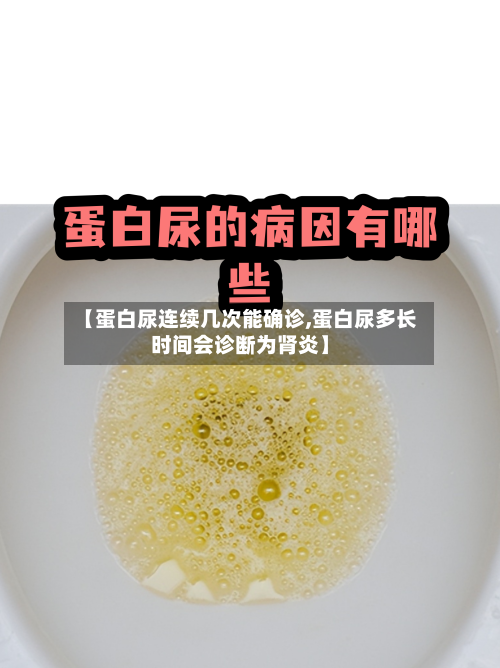 【蛋白尿连续几次能确诊,蛋白尿多长时间会诊断为肾炎】-第2张图片