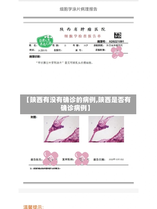 【陕西有没有确诊的病例,陕西是否有确诊病例】