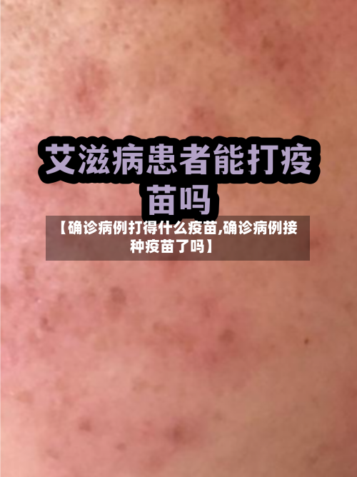 【确诊病例打得什么疫苗,确诊病例接种疫苗了吗】-第3张图片