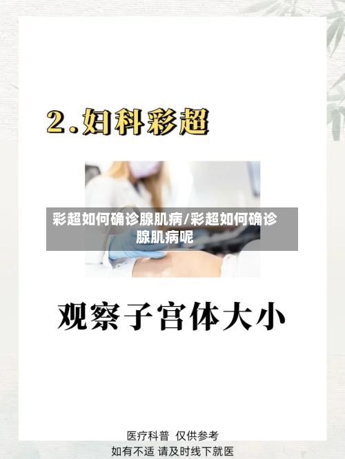 彩超如何确诊腺肌病/彩超如何确诊腺肌病呢-第2张图片
