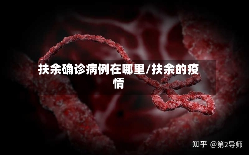 扶余确诊病例在哪里/扶余的疫情-第2张图片
