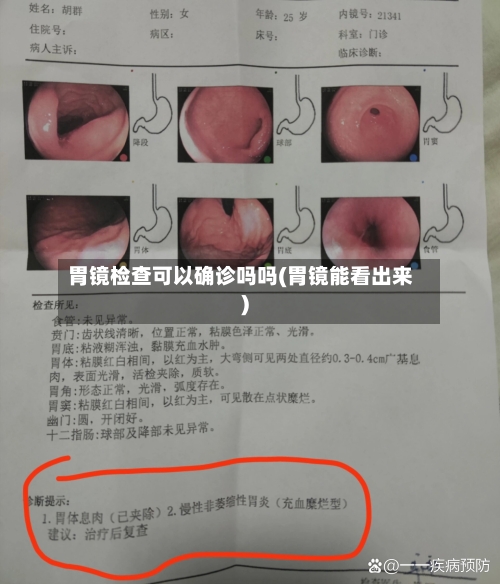 胃镜检查可以确诊吗吗(胃镜能看出来)-第2张图片