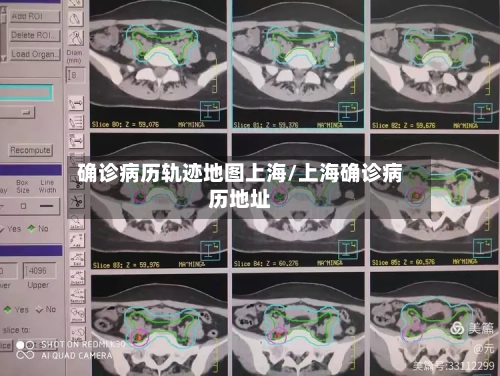 确诊病历轨迹地图上海/上海确诊病历地址
