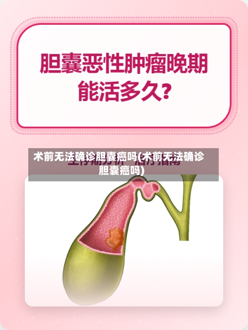术前无法确诊胆囊癌吗(术前无法确诊胆囊癌吗)-第2张图片