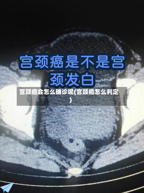 宫颈癌会怎么确诊呢(宫颈癌怎么判定)-第3张图片