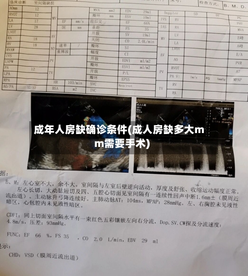 成年人房缺确诊条件(成人房缺多大mm需要手术)-第2张图片