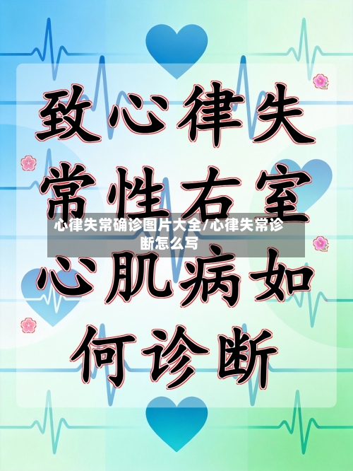 心律失常确诊图片大全/心律失常诊断怎么写-第2张图片