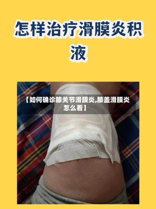 【如何确诊膝关节滑膜炎,膝盖滑膜炎怎么看】