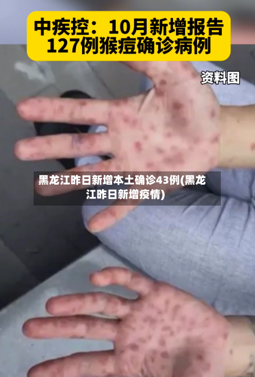 黑龙江昨日新增本土确诊43例(黑龙江昨日新增疫情)-第1张图片