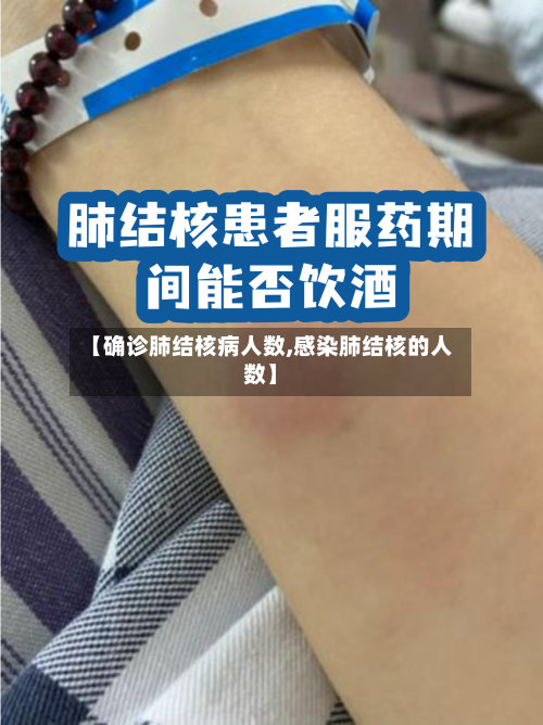 【确诊肺结核病人数,感染肺结核的人数】-第2张图片